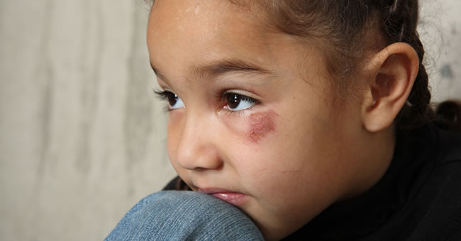 Responding to Child Abuse and Neglect